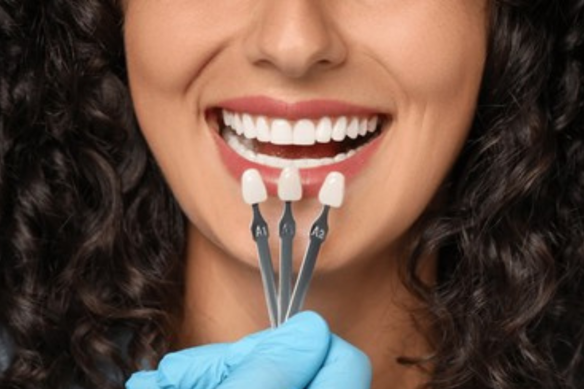 https://apexdental.net.in/wp-content/uploads/2025/05/GD-1.png