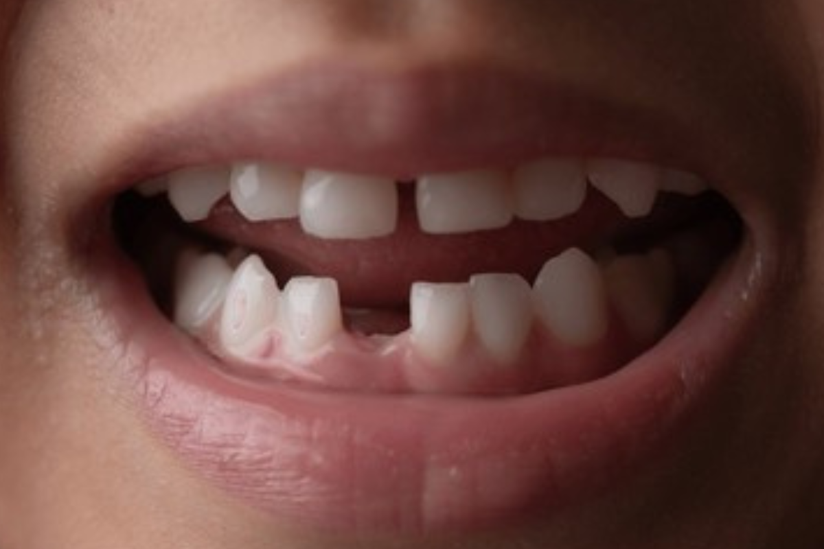 https://apexdental.net.in/wp-content/uploads/2025/05/GD-2.png