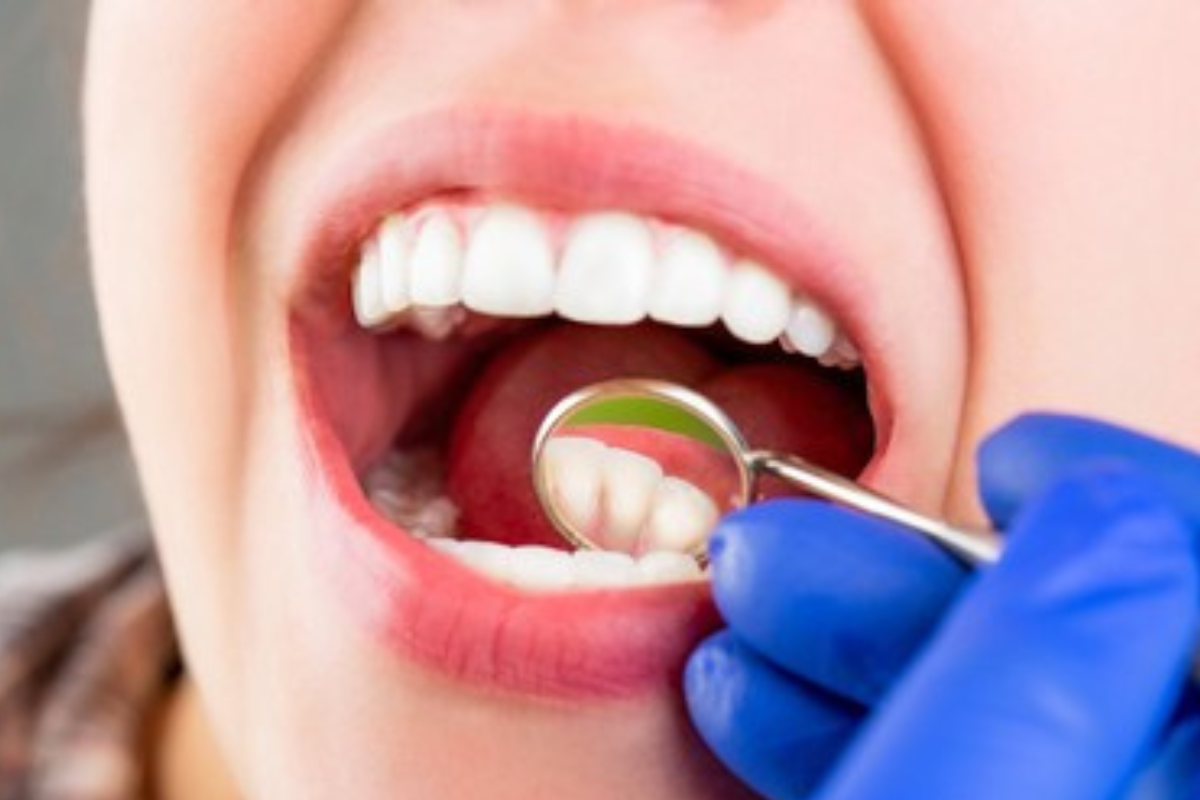 https://apexdental.net.in/wp-content/uploads/2025/05/GD.png