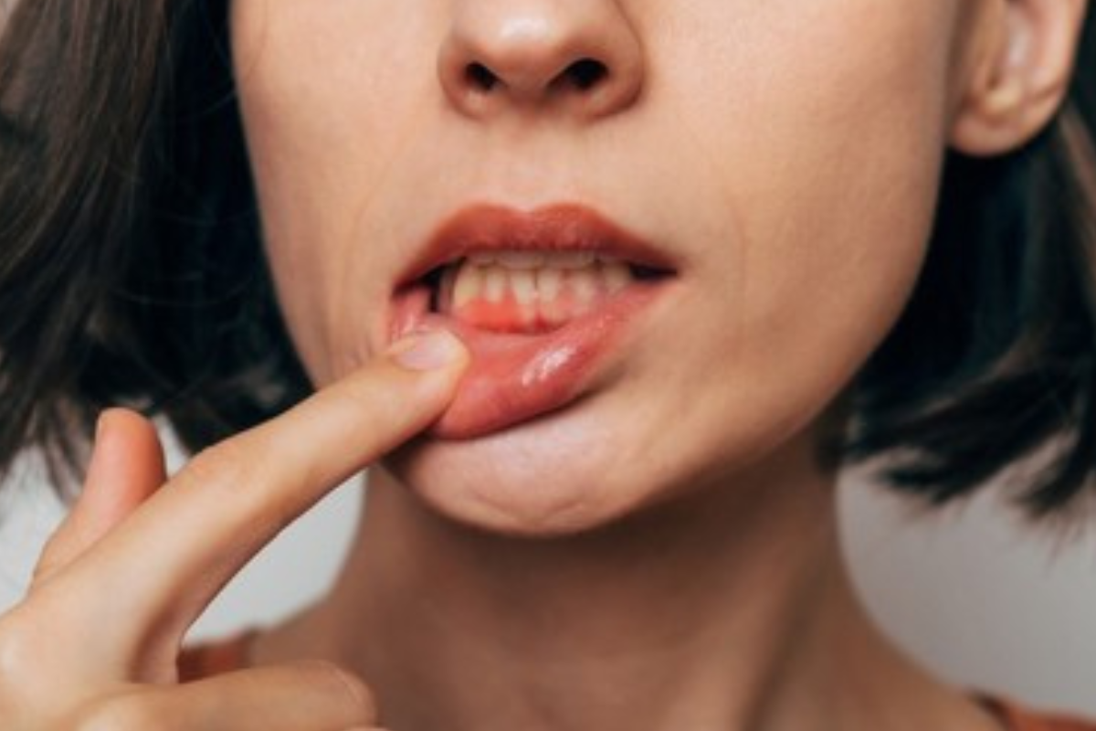 https://apexdental.net.in/wp-content/uploads/2025/05/di-1.png