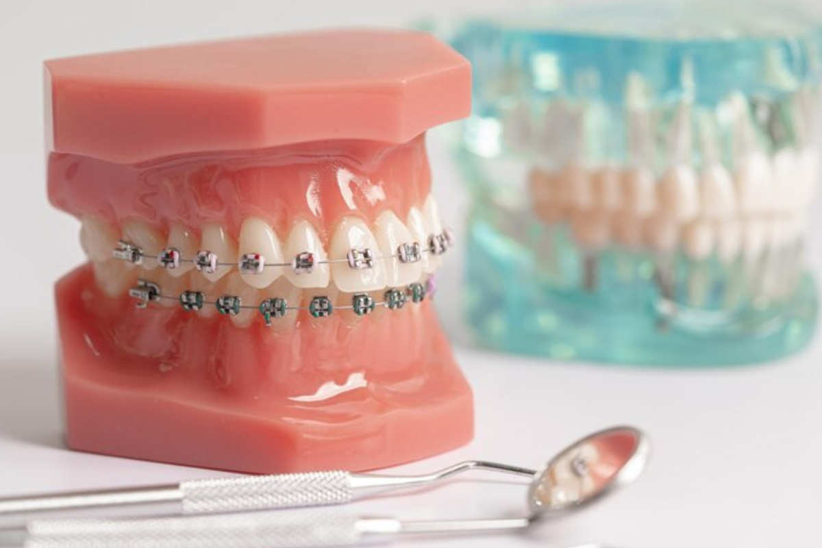 https://apexdental.net.in/wp-content/uploads/2025/05/di-2.png