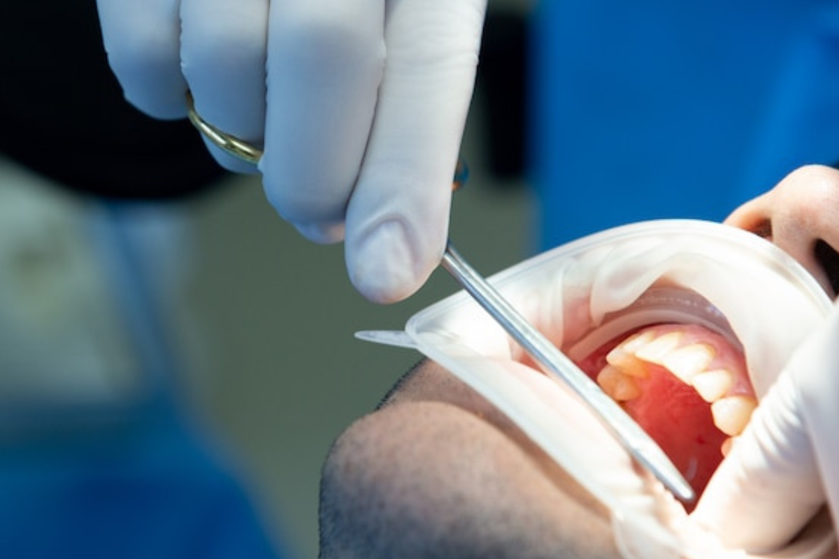 https://apexdental.net.in/wp-content/uploads/2025/05/di-4.png