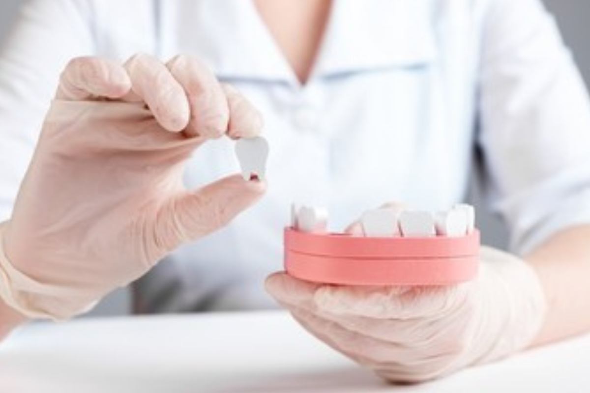 https://apexdental.net.in/wp-content/uploads/2025/05/di-5.png