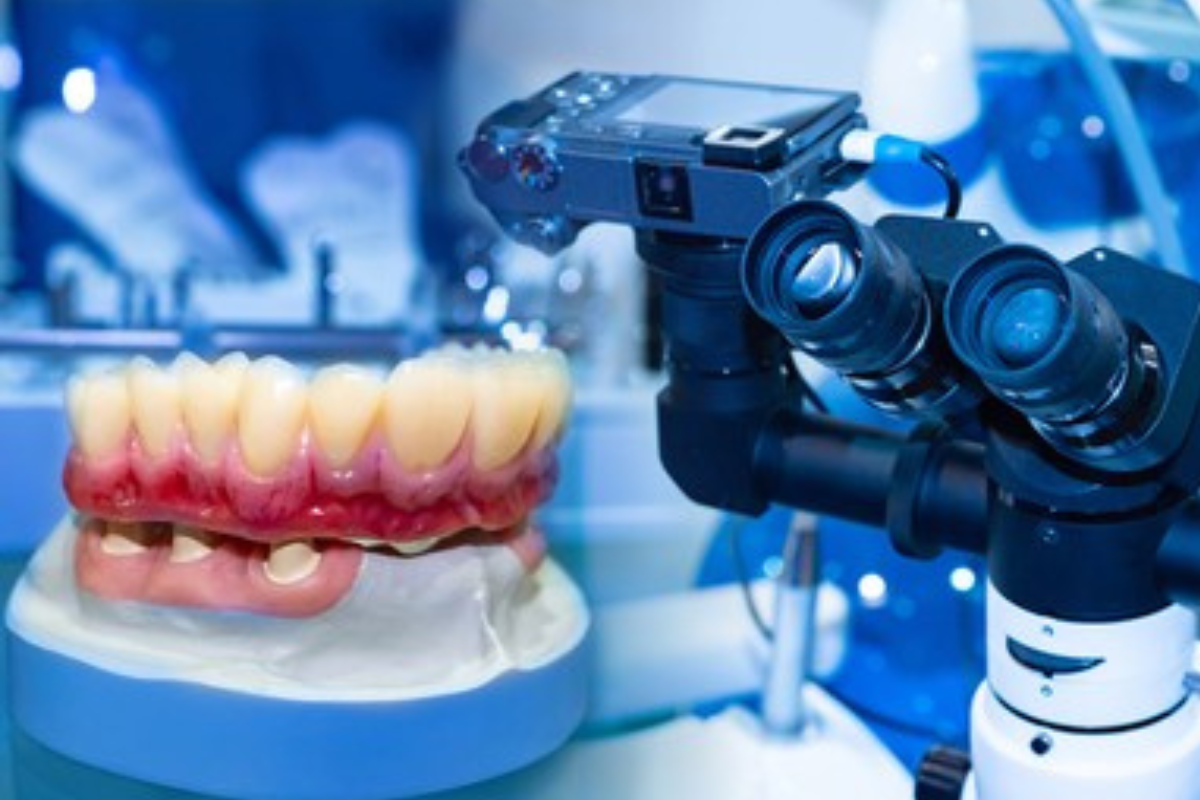 https://apexdental.net.in/wp-content/uploads/2025/05/di-6.png