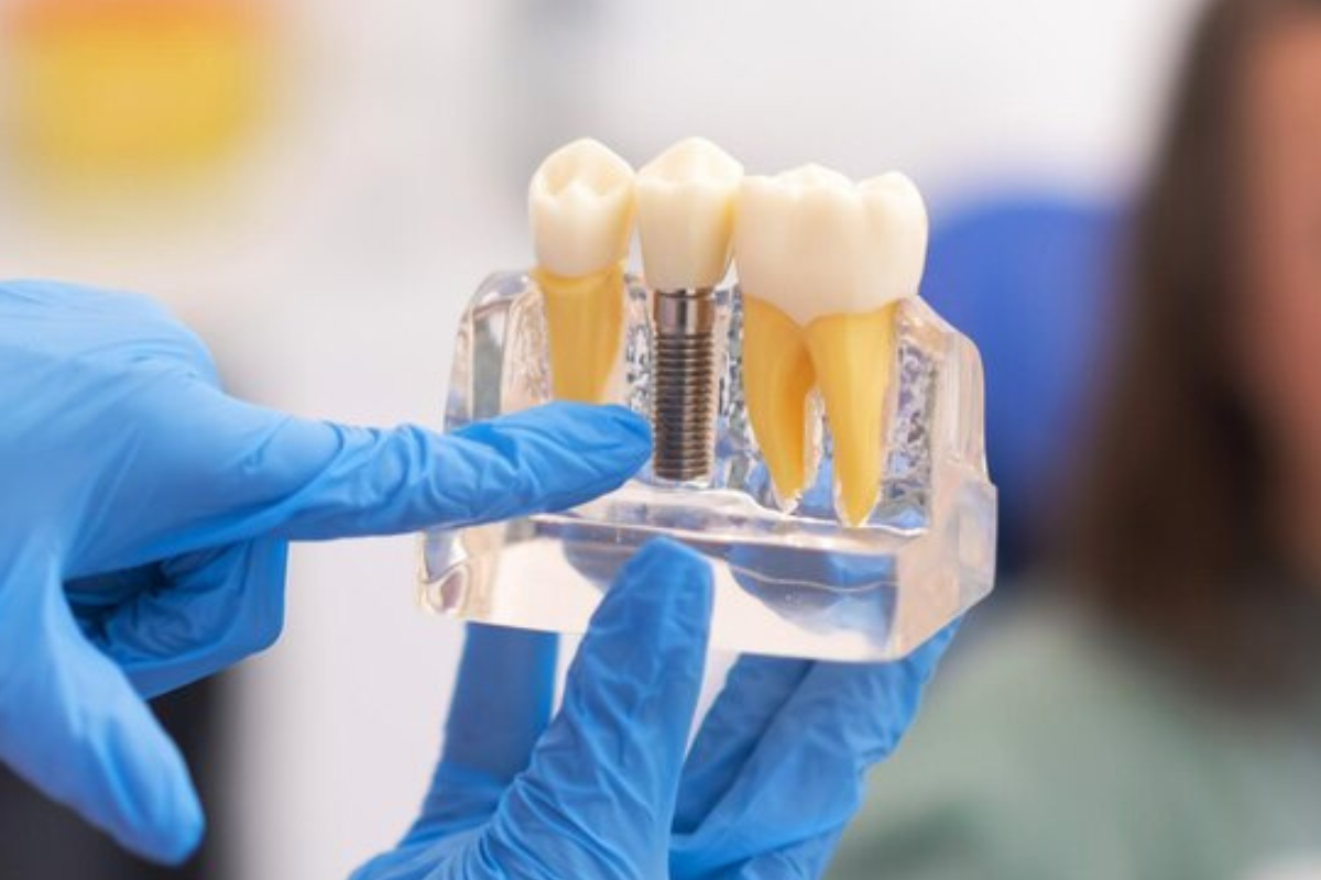 https://apexdental.net.in/wp-content/uploads/2025/05/di.png