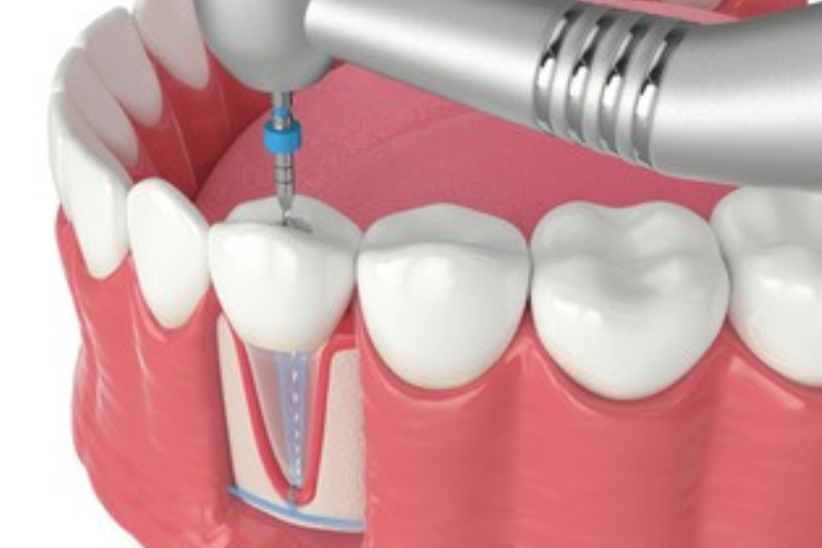 https://apexdental.net.in/wp-content/uploads/2025/05/ed.png